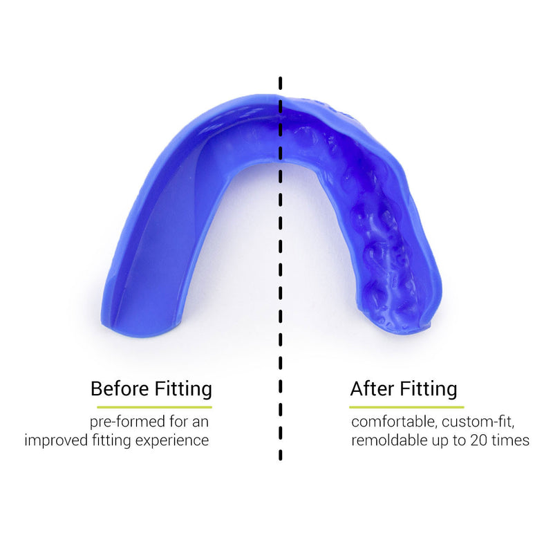 SISU Tether Mouthguard - Royal Blue - IndustraCare